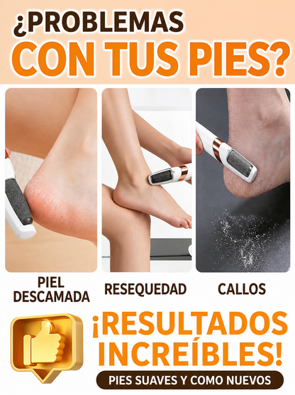 SoftFeet Pro™-Exfoliador Eléctrico para Pies